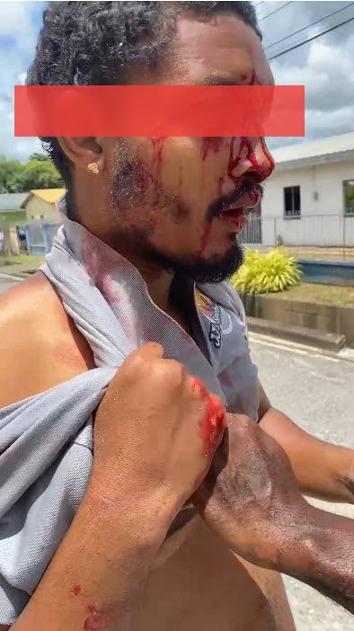 Man savagely beaten and chopped